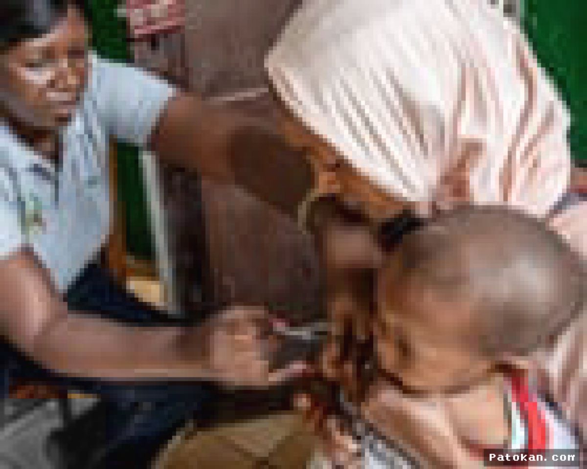 Guinea-Bissau — Anak-Anak Setengah Kasus Mpox saat Epidemi Meluas